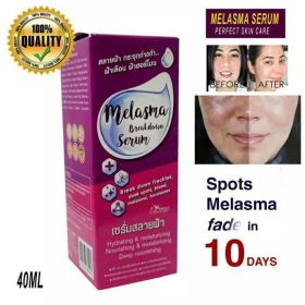 Serum Melasma Breakdown